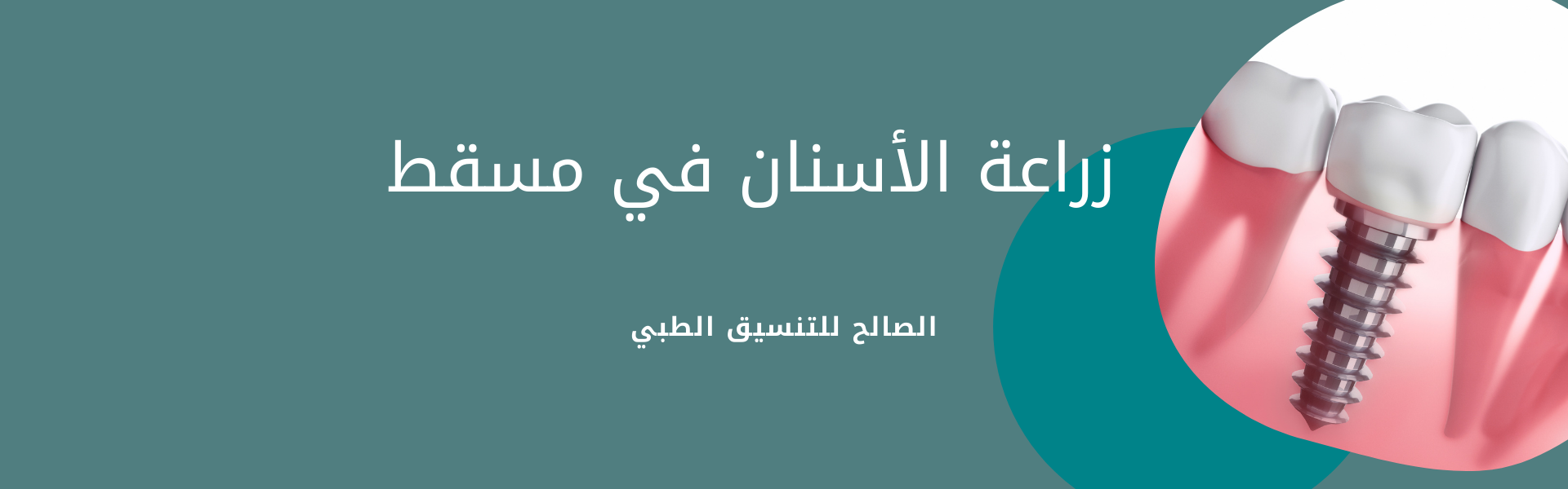 دليلك الشامل لزراعة الأسنان في مسقط| العيادات والمميزات